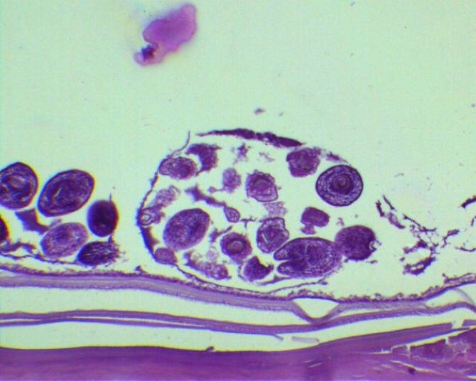 Echinococcus granulosus larvae in a hydatid cyst